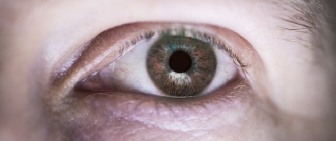 علاج القرنية المخروطية